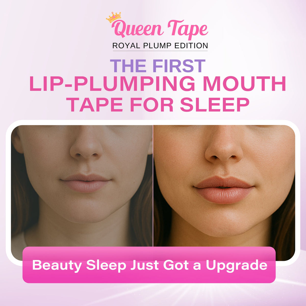 Queen Tape™ - Hydrating Collagen Mouth Tape